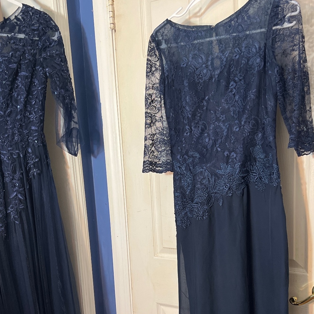 Woman’s dress